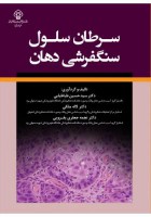 سرطان سلول سنگفرشی دهان
