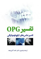 تفسیر OPG