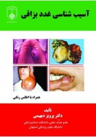 آسیب شناسی غدد بزاقی